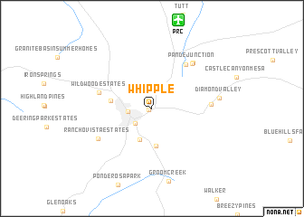 map of Whipple