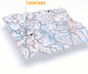 3d view of Tonocare