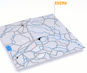 3d view of Edema